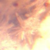 Cristales de calcita (o yeso) dispuestas en una estrella de diámetro inferior a 0,2 mm. Esta fotografía fue la mejor que podía hacer esta muestra. Pains, Minas Gerais, Brasil (Autor: Anisio Claudio)