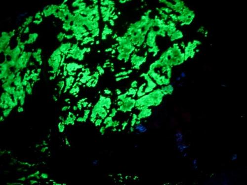 green fluorescent 005.JPG (Author: Glenn Rhein)