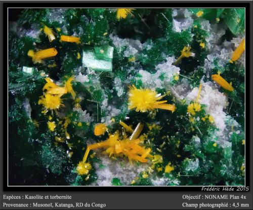 Kasolite and Torbernite<br />Musonoi Mine, Kolwezi, Kolwezi District, Lualaba, Katanga Copper Crescent, Katanga (Shaba), Democratic Republic of the Congo (Zaire)<br />fov 4.5 mm<br /> (Author: ploum)